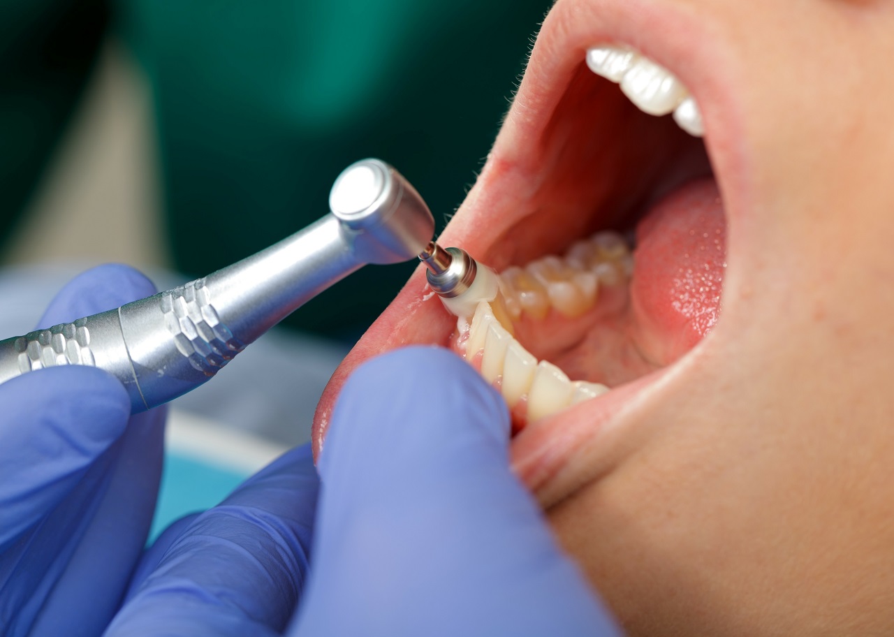 Nowoczesny sprzęt kluczem do efektywnego leczenia zębów