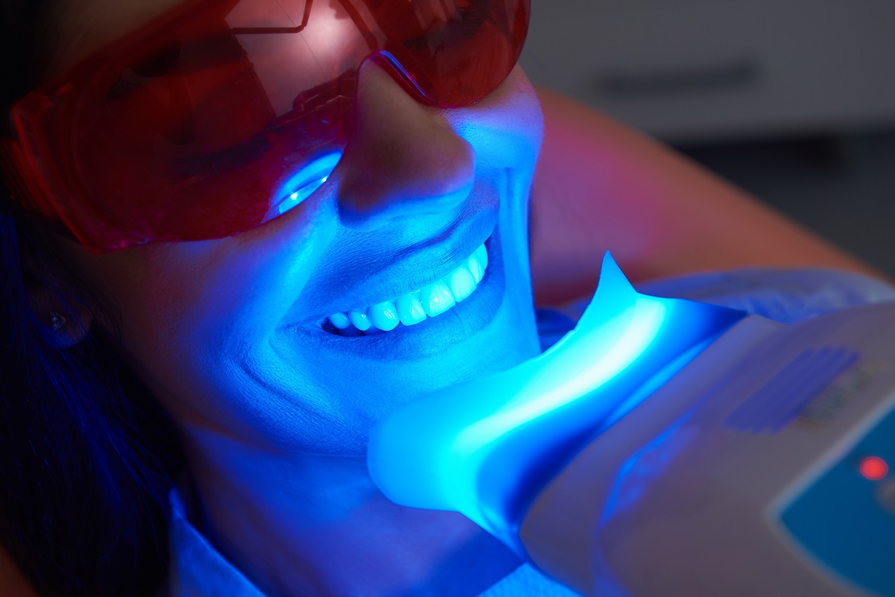 Wybielanie zębów – jak wygląda i czy warto o nim pomyśleć?